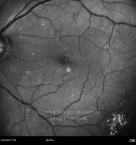 o04-ti01-2160324-20120413-001