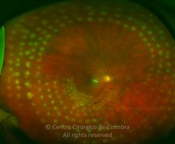 o04-ti02-2156012-20120124-999