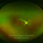 o04-ti02-2159988-20120424-998
