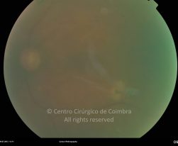 o04-ti02-2175366-20130709-003