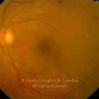 o04-ti02-5163-20071219-001