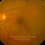 o04-ti02-5163-20071219-001