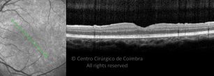 o04-ti03-2150207-20190308-004