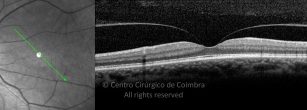 o04-ti03-2189941-20160527-004