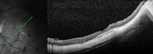 o04-ti03-4870-20190515-002