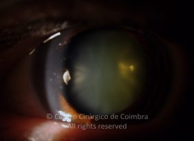 o04-ti12-2190731-20141202-002