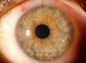 o04-ti12-4870-20101012-001
