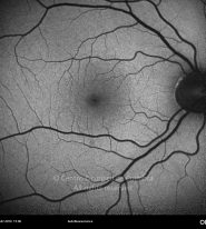 o04-ti15-129812-20100712-003