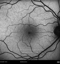 o04-ti15-2150363-20111025-005
