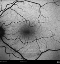 o04-ti15-2171646-20130319-003