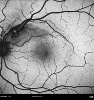 o04-ti15-3676-20091019-002