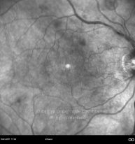 o04-ti16-2138876-20110310-003