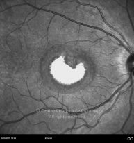 o04-ti16-2154002-20111028-003