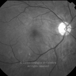 o05-ti02-11941-20080317-003