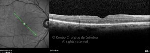 o05-ti03-2136205-20100713-004