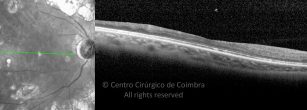 o05-ti03-23032-20190726-002