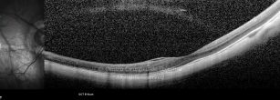 o05-ti03-4870-20100624-001