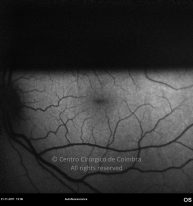 o05-ti15-18437-20111121-004