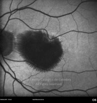 o05-ti15-2149554-20110608-001