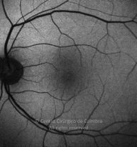 o05-ti15-2175836-20170726-007
