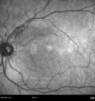 o05-ti16-3676-20100930-003