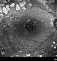 o06-ti01-11670-20120628-001