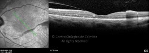 o06-ti03-129737-20100318-004