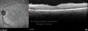 o06-ti03-2150613-20120111-005