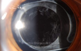o06-ti12-993-20100118-001