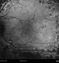 o06-ti15-2144284-20111125-003