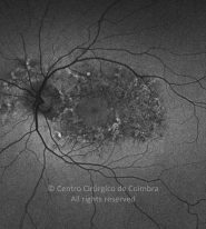 o06-ti15-2176527-20130820-007