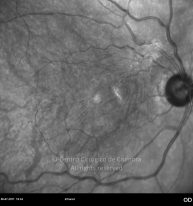 o06-ti16-1621-20110706-003