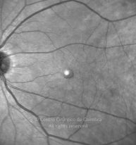 o06-ti16-2189941-20161004-005