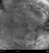 o07-ti01-131915-20100409-002