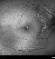 o07-ti01-27203-20100413-002