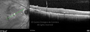 o07-ti03-3124-20110429-006