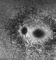 o07-ti15-2154655-20120511-732