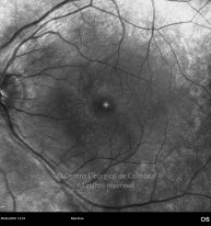 o08-ti01-131915-20100409-003