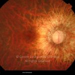 o08-ti02-993-20100118-001