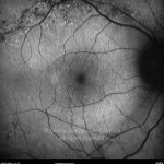 o08-ti15-131022-20100316-004