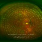 o09-ti02-4024-20120316-998