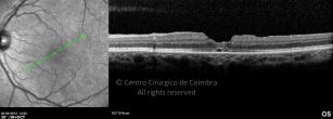 o09-ti03-2150207-20120222-006