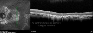 o09-ti03-4417-20111012-006