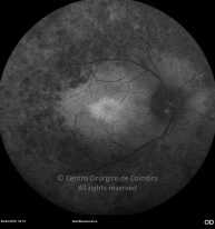 o09-ti15-131915-20100409-001