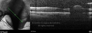 o10-ti03-116547-20110824-002