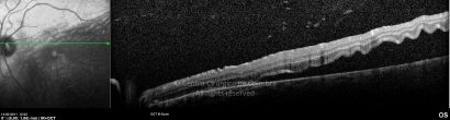 o10-ti03-2146468-20110314-009
