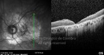 o10-ti03-4417-20120417-004