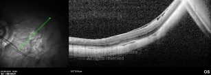 o10-ti03-4870-20100624-006