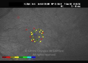 o10-ti14-2134513-20100607-001