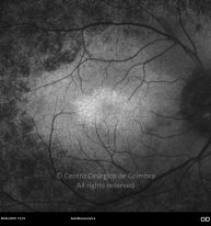 o10-ti15-131915-20100409-004